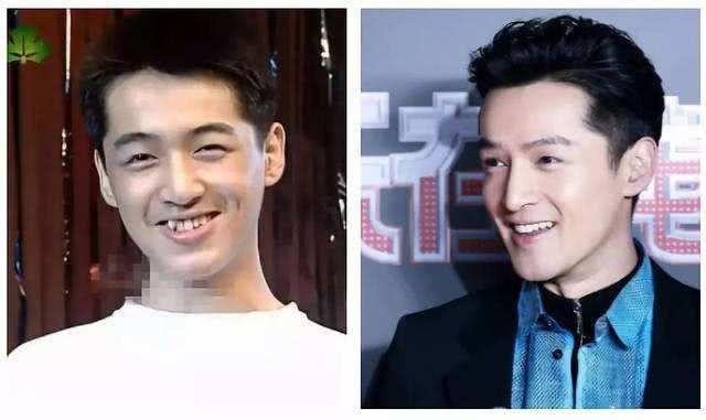 整牙可能是最厉害的整容了,林心如变化大,胡歌没整牙前是路人!