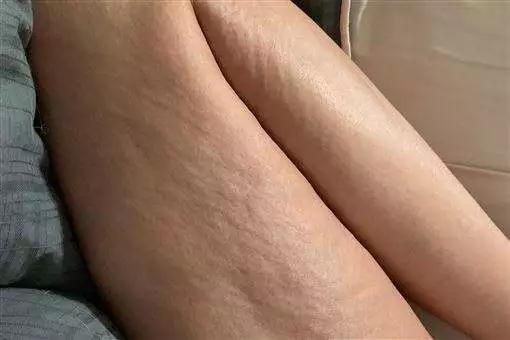 女艺人陈艾琳产后身材曝光,产前大腿满满橘皮跟脂肪让她崩溃