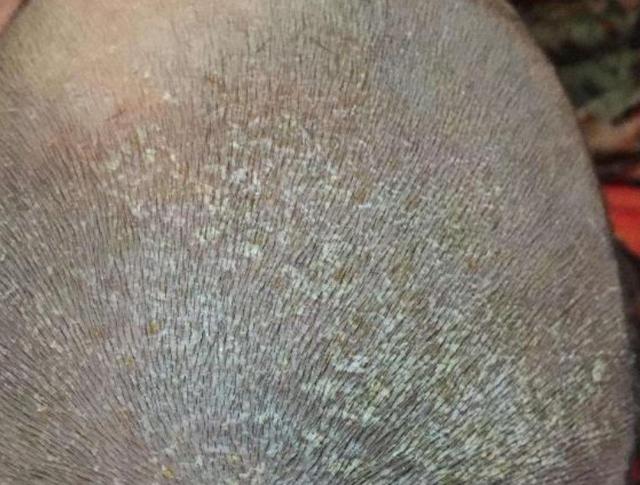 新手妈妈清理乳痂,如此做更好|新生儿|乳痂|头皮_新浪新闻