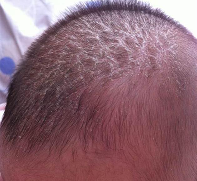 新手妈妈清理乳痂,如此做更好|新生儿|乳痂|头皮_新浪新闻