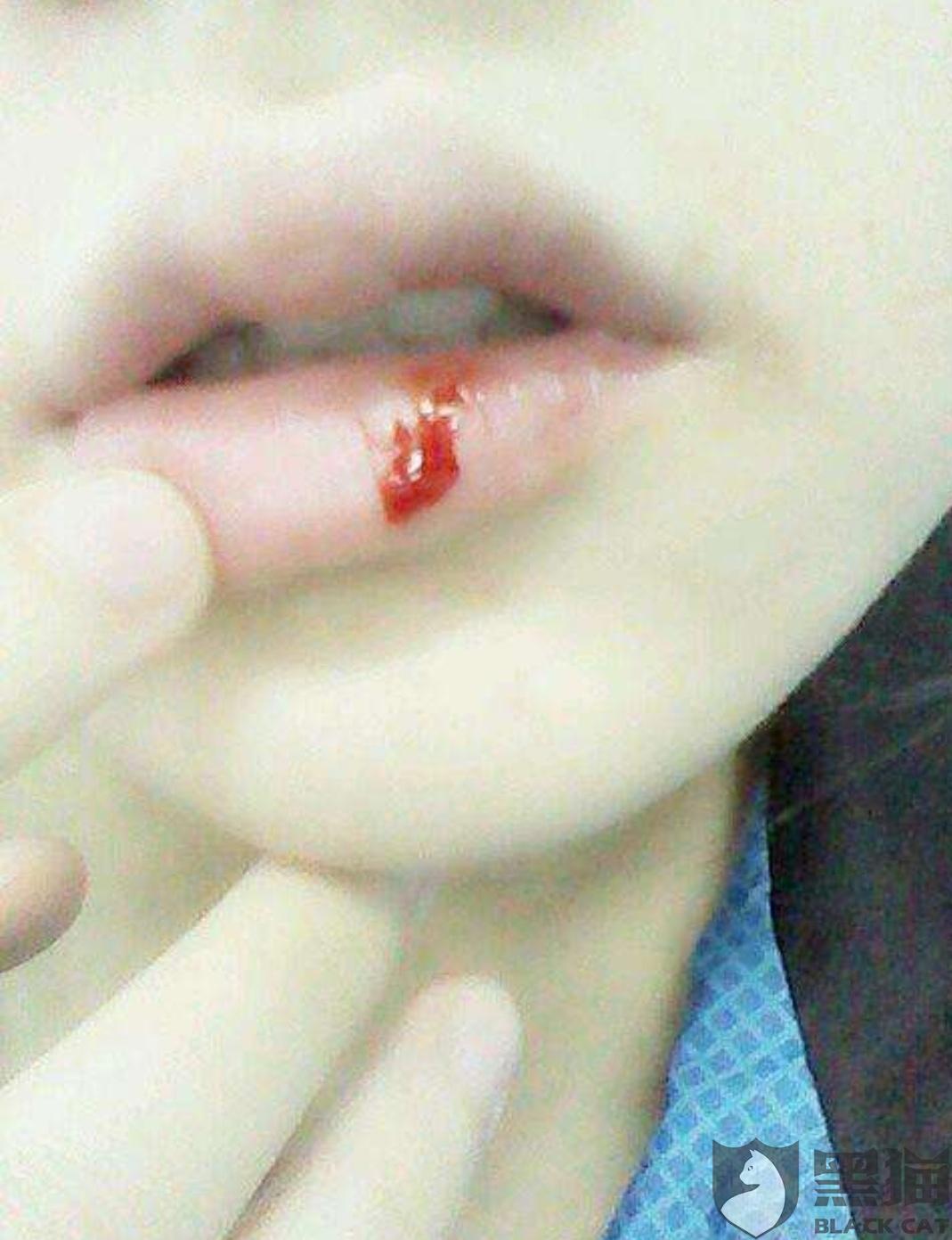 玻璃手机:黑猫投诉:饭里有异物玻璃片