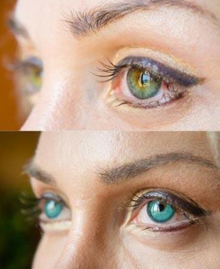 女子整容全身,变色眼睛厚嘴唇,取掉四根骨头将腰变成胳膊粗