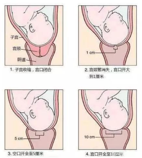 生孩子示意图图片