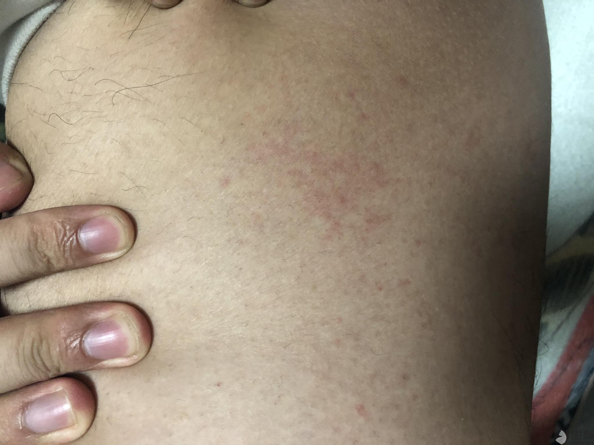 黑猫投诉:淘宝店铺胖胖哥大码男装8090,卖的裤子酸味大,穿后过敏