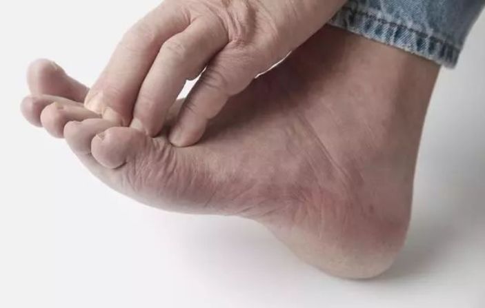 血管堵塞时脚上会出现3个异常若没有血栓离你还很远