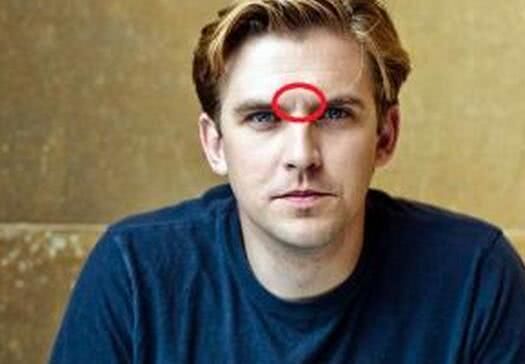 短命的人,往往有三处"发黑",两处"变大",若你也是,别忽视