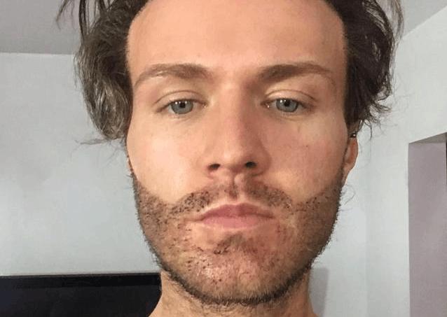 男子因胡子稀疏不自信,花9000英镑移植,最后都称帅呆了