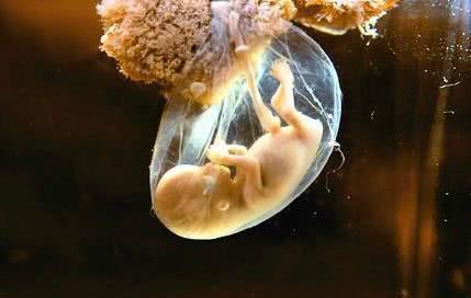 37周,孕妈妈"羊水早破"去医院,医生怒斥其老公"无知"|羊水|胎膜|胎儿