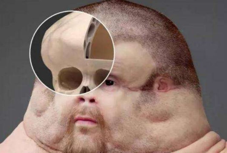 专家:几百年后,我们的脸上或会多点东西