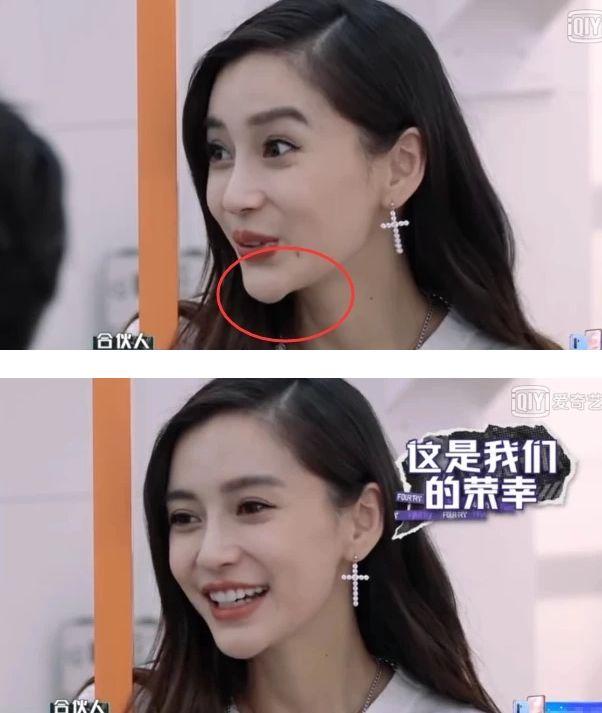 baby的"奇怪下巴"上热搜,看到谢娜的澄清,她真没说谎