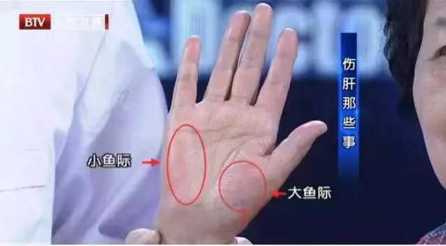 大小鱼际皮肤常会出现了片状充血,或是红色斑点,斑块,按压后变成苍白