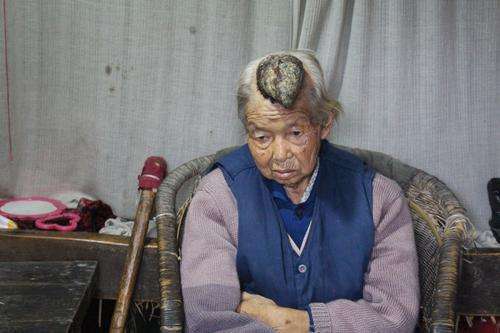 八旬老人头上长犄角误以为能真龙转世让人惊呆