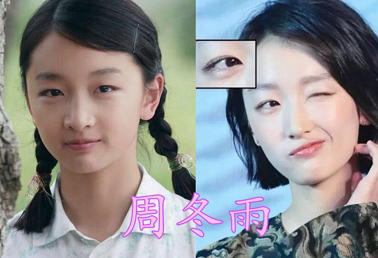 周冬雨,对于她有没有割双眼皮这件事情还是很有争议的,不过照片对比的