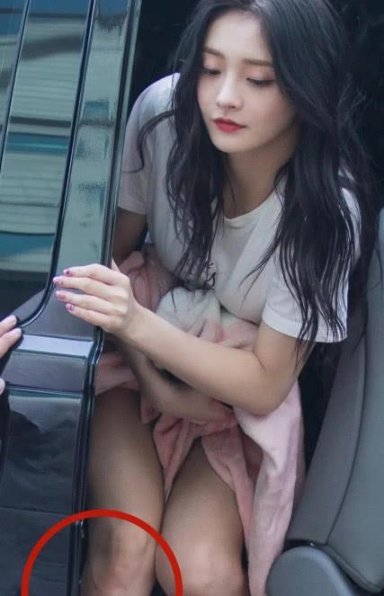 难怪周洁琼从来不露腿,当看到她"膝盖"的那刻,网友泪目