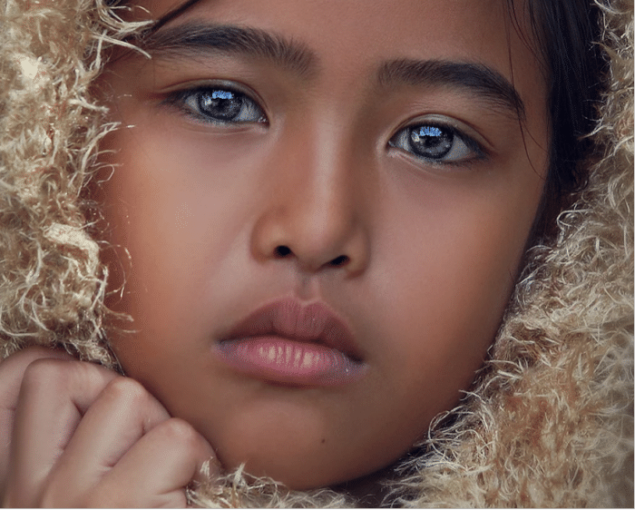 国外一个小女孩有"三只眼睛", 经过检查验证, 仍旧无法破解