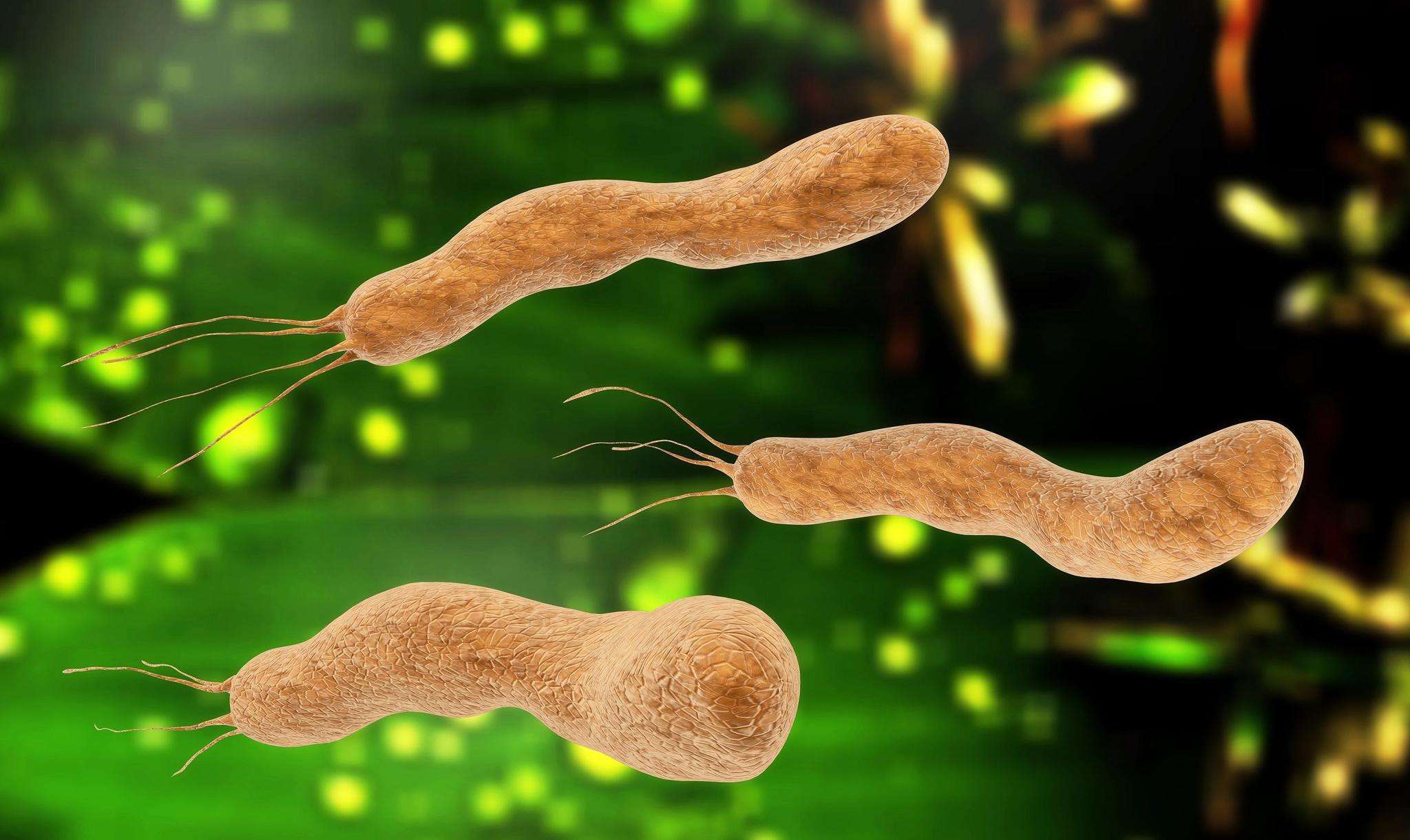 幽门螺旋杆菌感染是不是患上胃癌?