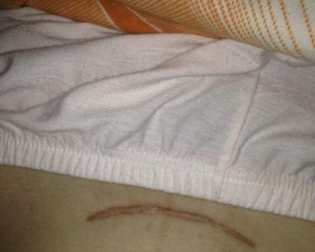 同样是剖腹产,为什么你的疤痕特别明显?4个因素不容忽视|疤痕|剖腹产|伤口_新浪新闻