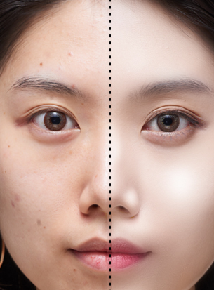 脸上瑕疵太多遮不住,教你怎么选对遮瑕,让你从此"再也没瑕疵"