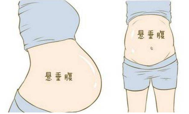怀孕后肚子很大但从背后看不出怀孕疑似悬垂腹孕妈需谨慎