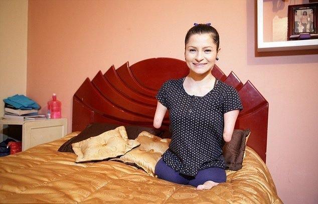 漂亮女孩天生四肢残缺但她身残志坚如今成为励志演说家