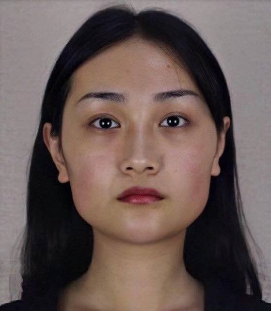 太神奇了小姐姐磨骨90天全纪录从正宗国字脸变成小v脸