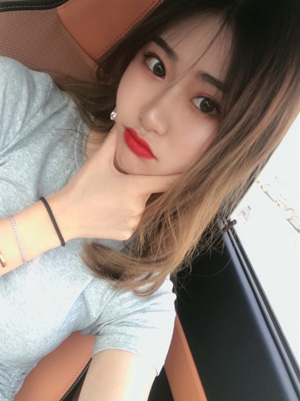 23岁女生脂肪填充,90天真实纪录,以前像30岁,现在像18