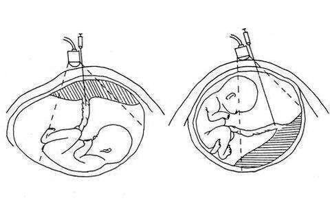 美联储为何突然宣布降息
