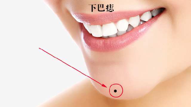 下巴痣丰满有肉的下巴长着一颗黑痣,寓意财富将伴随一生,通常不动产会