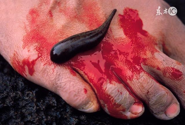 农村水田里常见的一种虫子,吸血为生,却有神奇功效