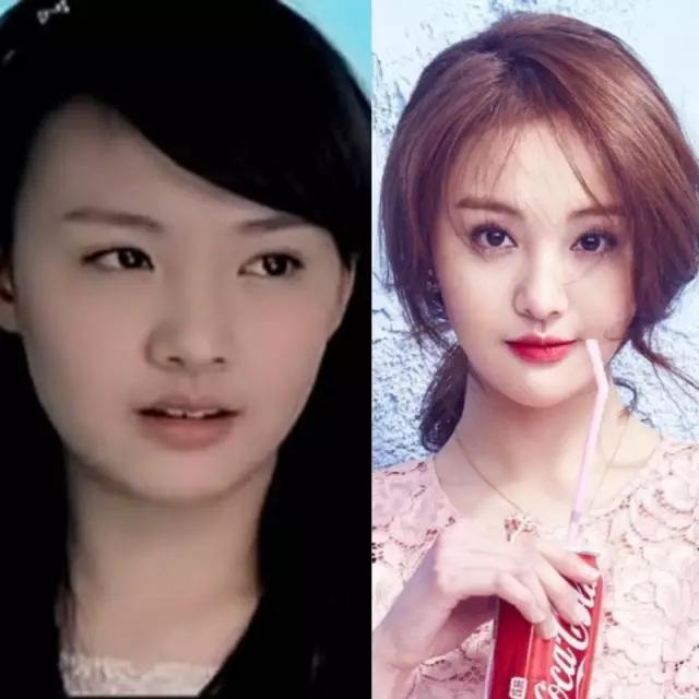 盘点娱乐圈女星整容前后对比