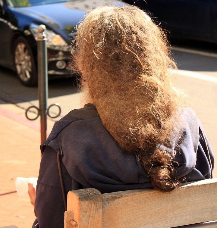 世界上竟有这么懒的人,头发都懒得洗,十几年下来成死结