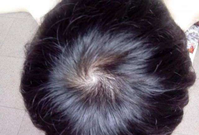 关于发旋，你都听说过哪些说法？一顶横，二顶楞？|旋儿|俗语|毛发_新浪新闻