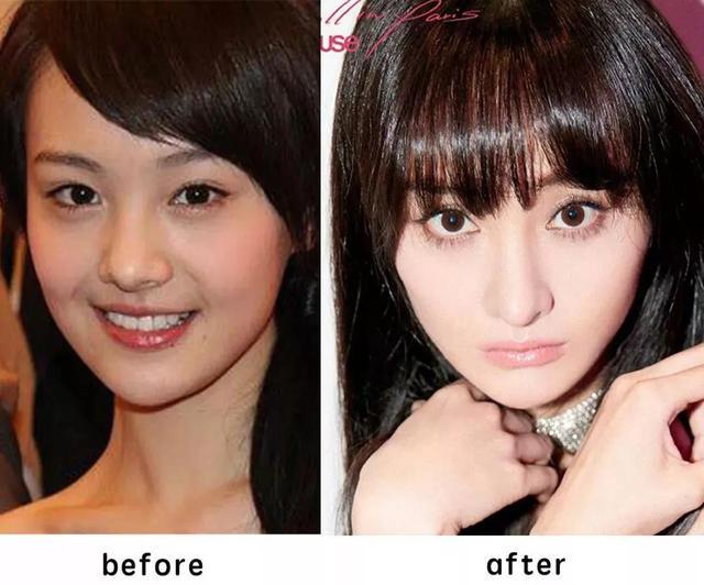 郑爽整容也不是什么秘密,不过对比之前的颜值,小编还是觉得有点可惜.