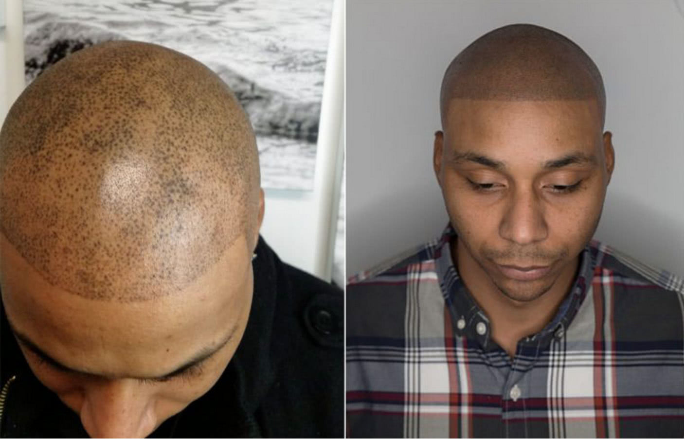 秃顶男子想要头发无奈请纹身师纹头发效果令人无奈