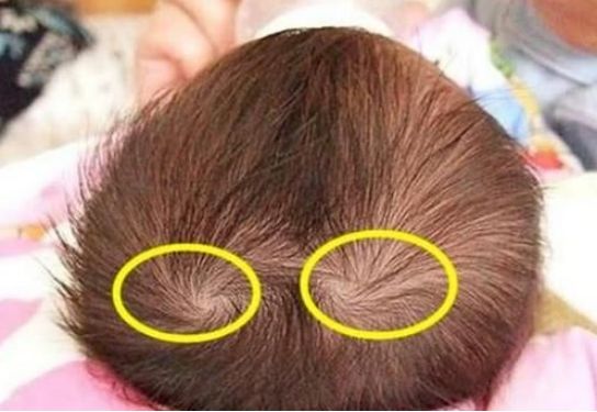 婴儿眉尾有旋的图片图片