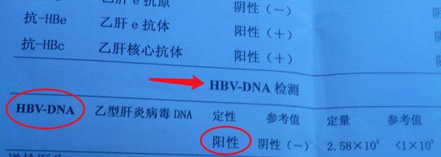 乙肝病毒量高,表面抗原阳性,就应该及时进行抗病毒治疗吗?__财经头条