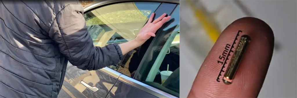 惊掉你的下巴！ 美国一男子将特斯拉钥匙芯片植入手背！