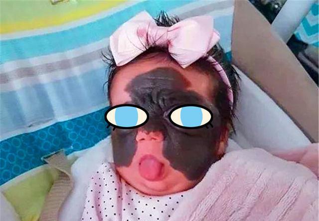 妈妈生下"蝙蝠侠"胎记宝宝,拍照鼓励女儿却被网暴:她是个怪物