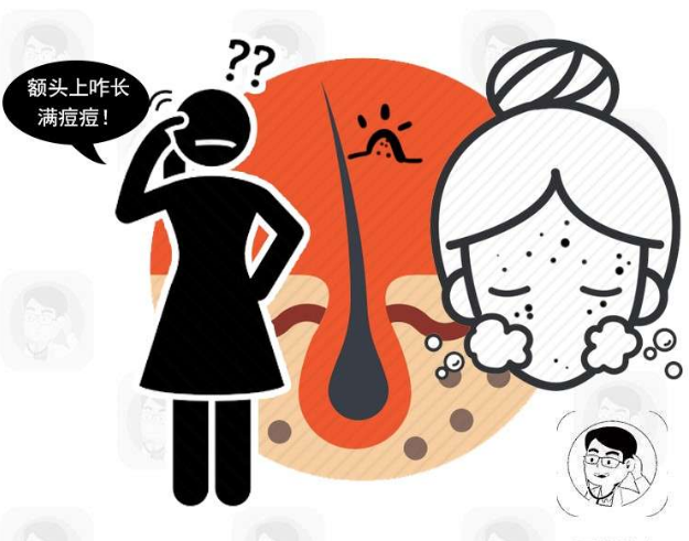 医生:小心这3种疾病的侵害|脓包|头皮|脂溢性皮炎_新浪新闻