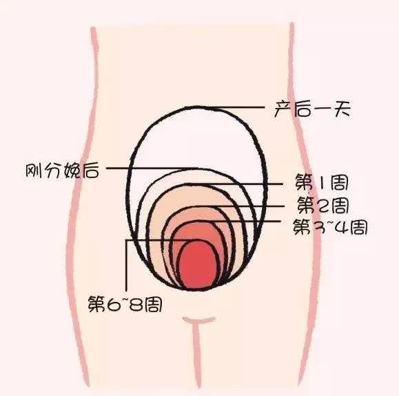多数人都不清楚,二胎之后才更明显|剖腹产|疤痕|二胎_新浪新闻