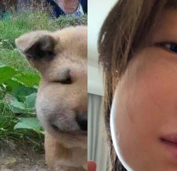 周冬雨晒拔完智齿后自拍,脸肿得像在嘴里塞了颗鸡蛋,心疼又好笑