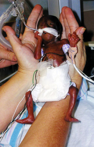 宝宝脑袋只有网球大,身子只有小碗