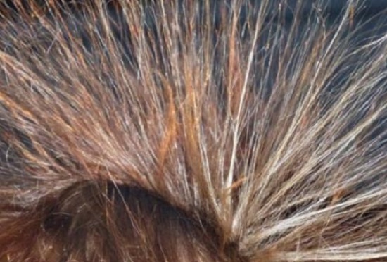 天气干燥头发起静电怎么办如何防治