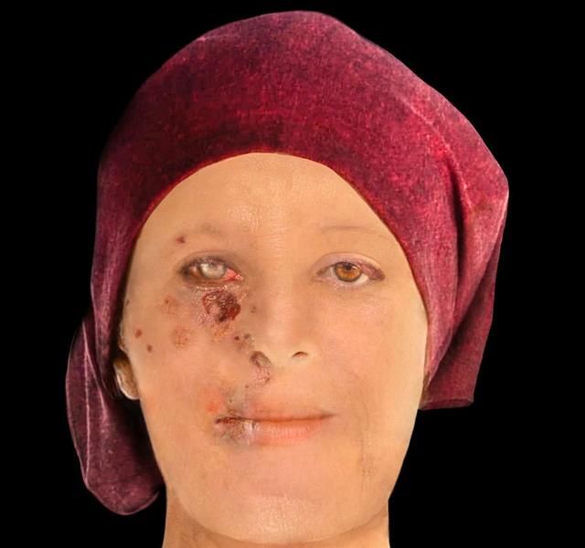 英国法医重建500年前麻风病人的"烂脸",还有900年前的正常脸