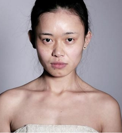 女子还经常到医院注射肉毒杆菌,女子称,整容给她带来了很大的自信,她