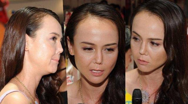 未婚夫肝癌离世至今单身前tvb女星鼻梁意外崩塌如今转型成主播