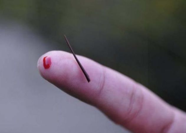 手上扎了刺不要再用针挑,教你个好方法,不出3秒刺儿自己跑出来