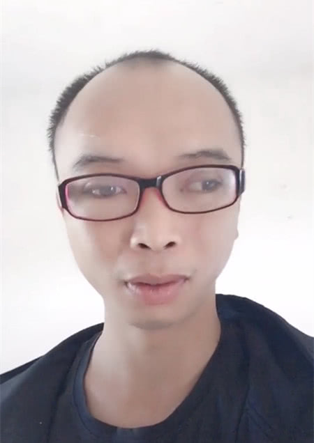 男子自称抖音最帅,惊人发际线更是瞧蒙众人,网友:外星人
