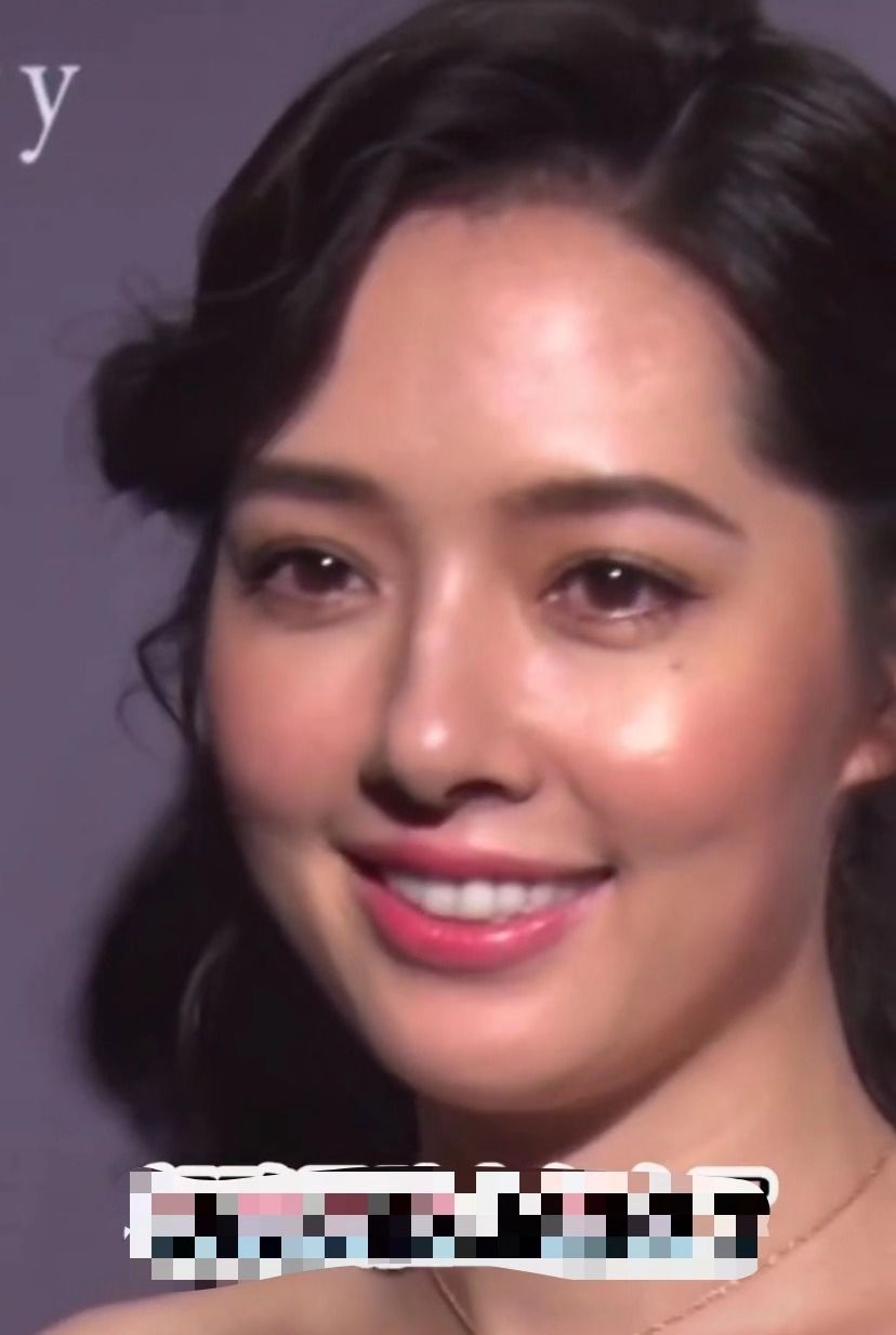 郭碧婷嫁向佐越来越丑?生图脸僵下巴歪苹果肌肿,满脸油腻全是坑