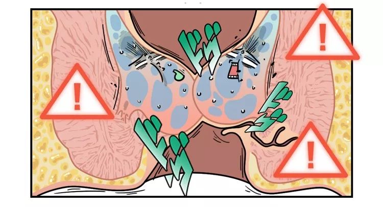 人类的痔疮到底是多大的疼痛